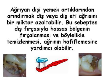 Diş ağrısının hafifletilmesi